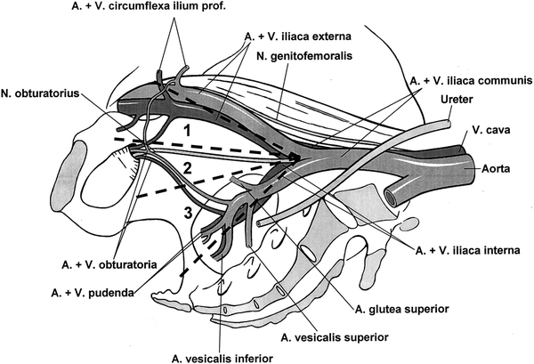 A304279_1_En_1036_Fig2_HTML.gif