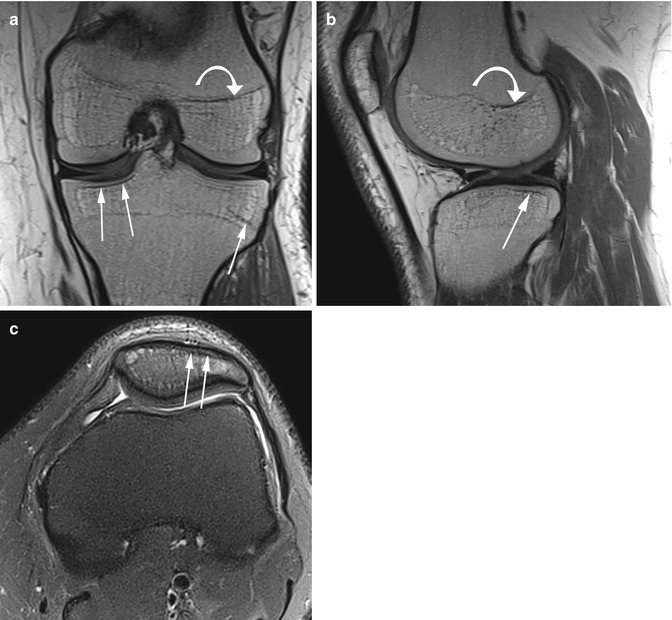 Bones | Radiology Key