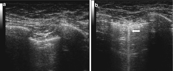 Pediatric Polytrauma Management | Radiology Key