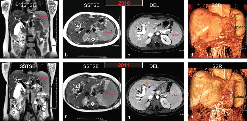 liver-parenchymal-disorders-radiology-key