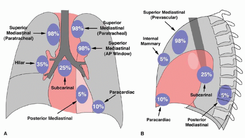 Lymphoma and Lymphoproliferative Disease | Radiology Key