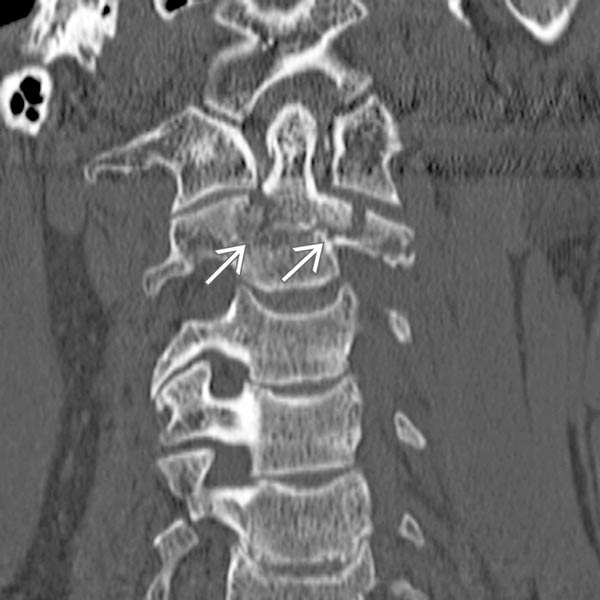 Fracture Classification Radiology Key