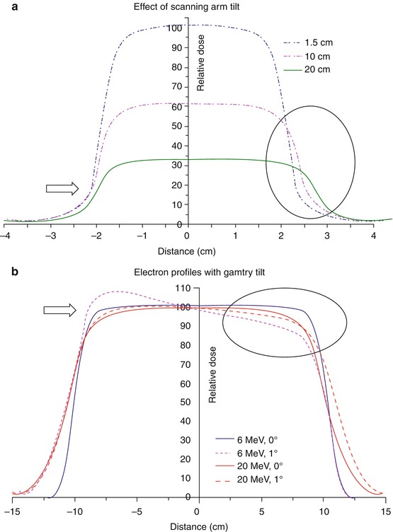 A217879_1_En_4_Fig2_HTML.jpg