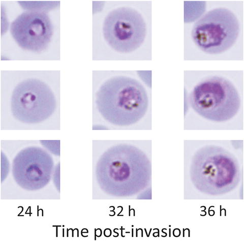 plasmodium falciparum peritoneal fluid