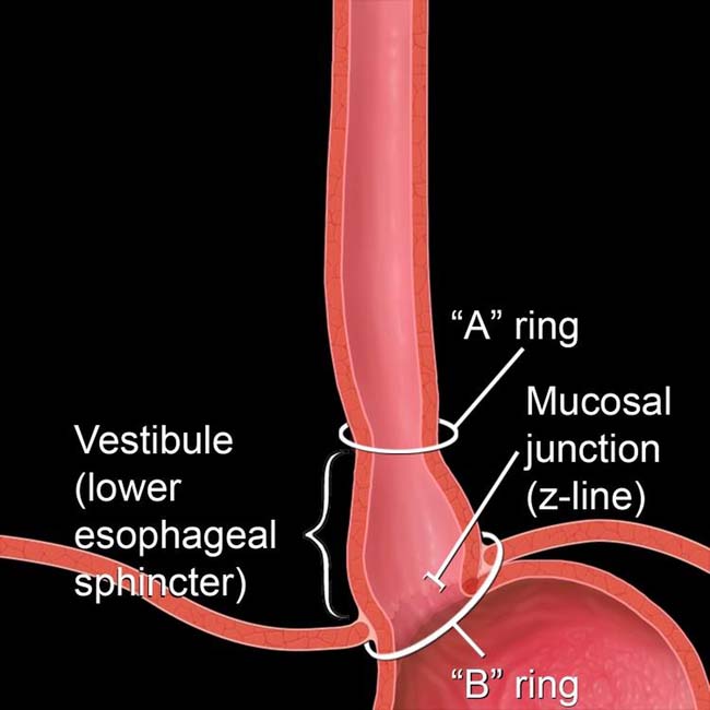 Anatomy of esophagus longitudinal muscle. LES, lower esophageal