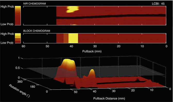 A270896_1_En_10_Fig3_HTML.gif