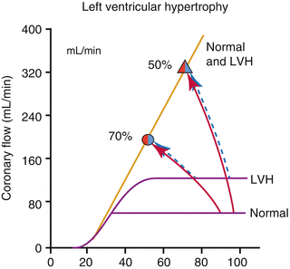 Physiology of Coronary Blood Flow | Radiology Key