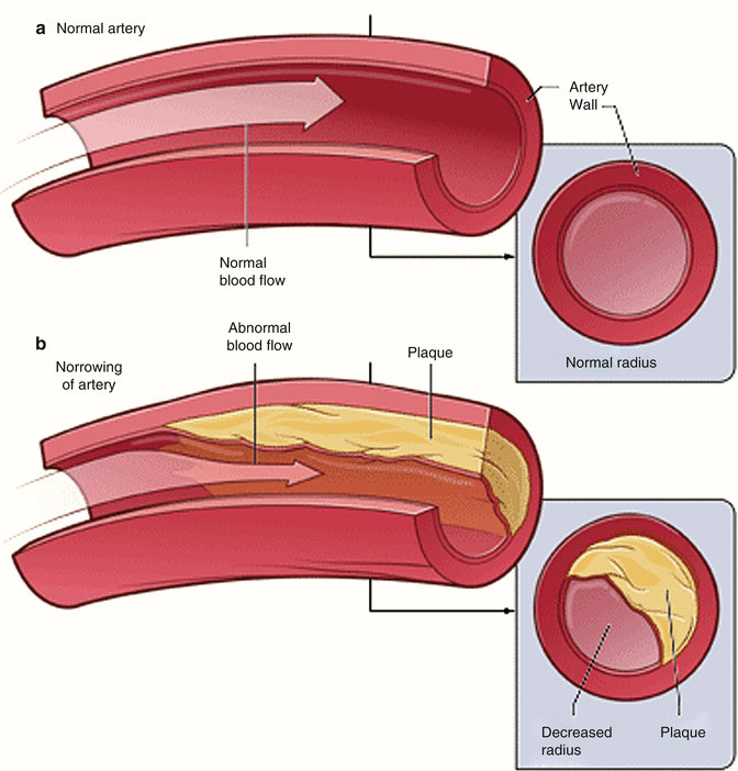 A312522_1_En_2_Fig3_HTML.gif