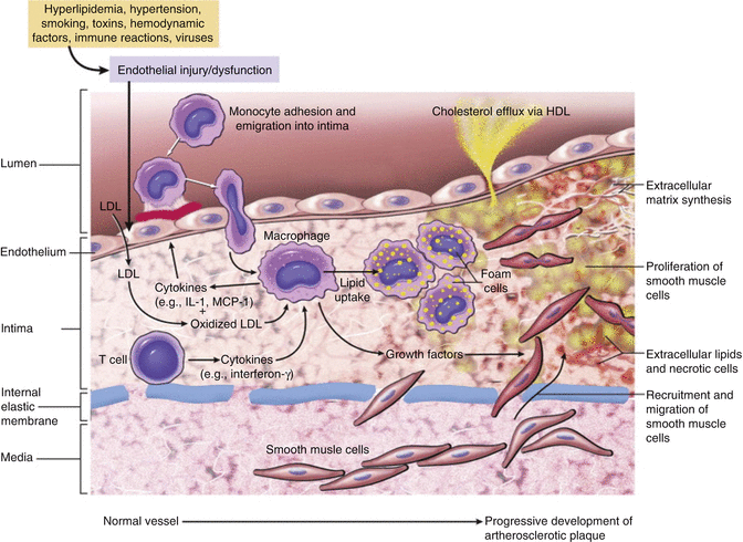 atherosclerosis pathophysiology