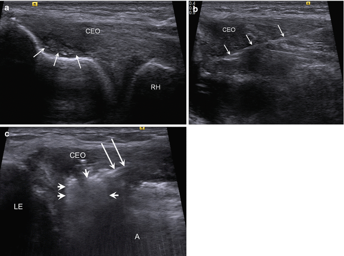 The Role Of Ultrasound In Sports Medicine 