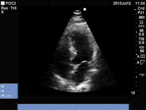 curvilinear probe ultrasound pediatric