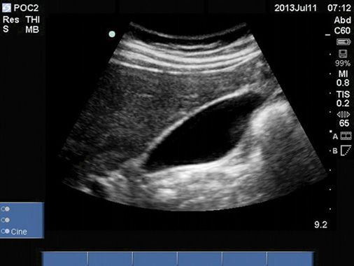 Types Of Devices Radiology Key