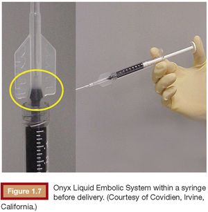 Onyx Liquid Embolic System