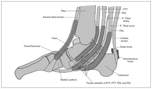 Common Ankle And Foot Problems Radiology Key