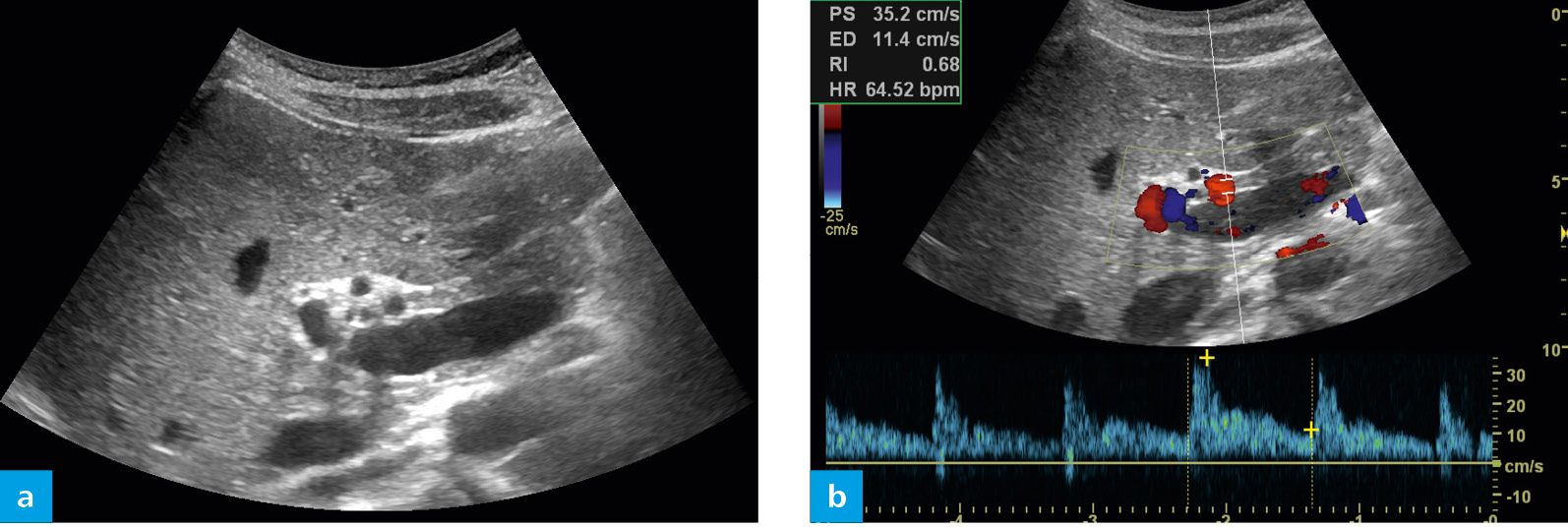 CPC | Radiology Key