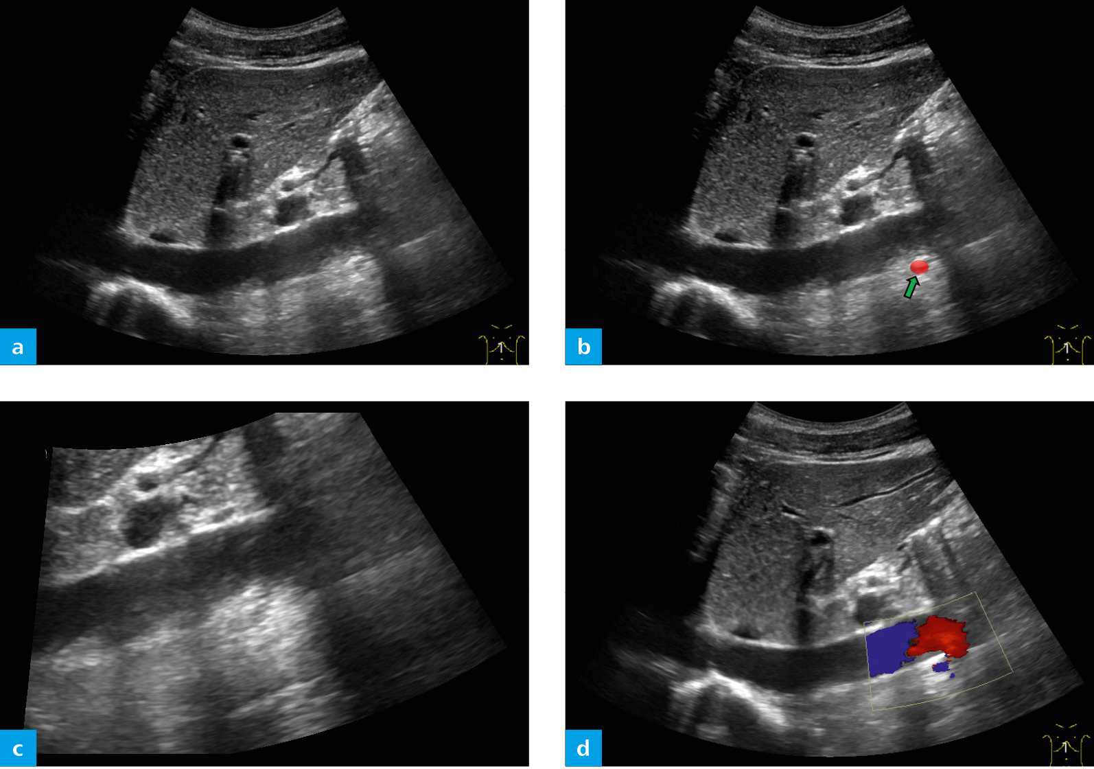 arteries | Radiology Key