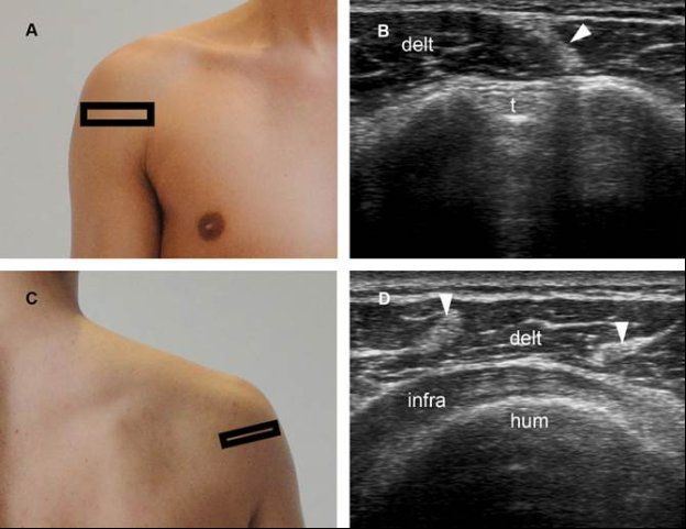 Spectrum Of Findings Radiology Key
