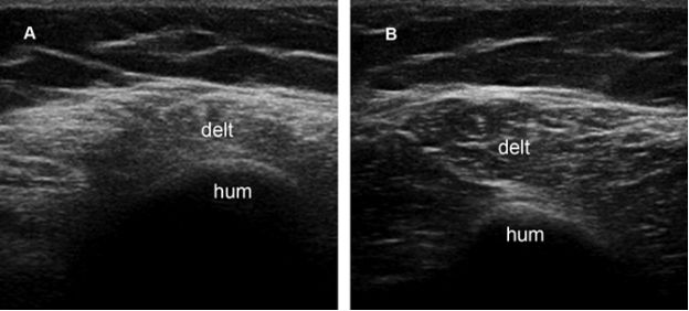 Spectrum Of Findings Radiology Key