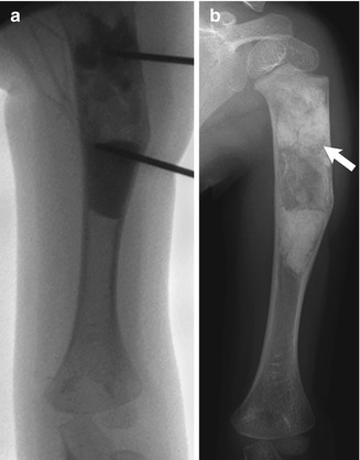 Orthopedic Procedures | Radiology Key