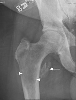 Difficult Cases | Radiology Key