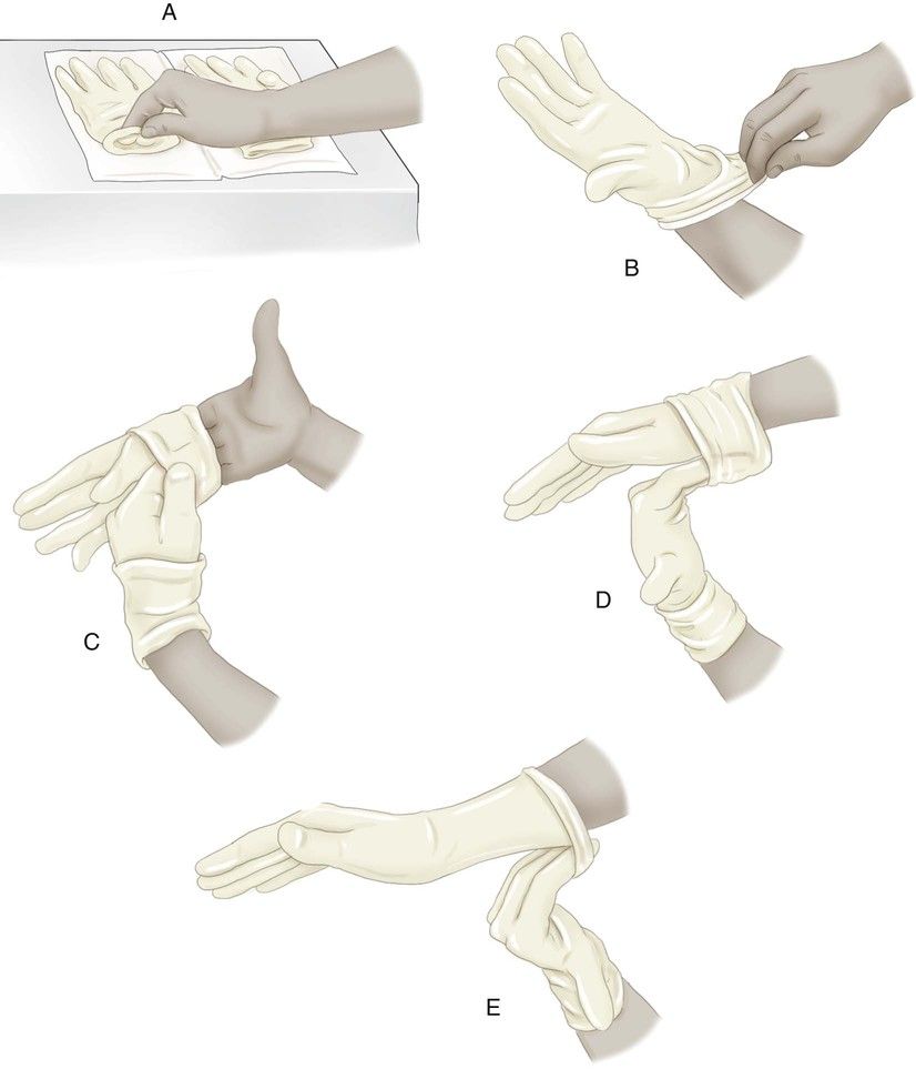 Надевать стерильные перчатки в случаях. Стерильные перчатки. Техника одевания стерильных перчаток. Снятие стерильных перчаток алгоритм. Медицинские перчатки алгоритм надевания.