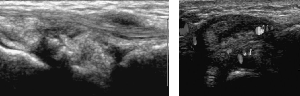 Difficult Cases | Radiology Key