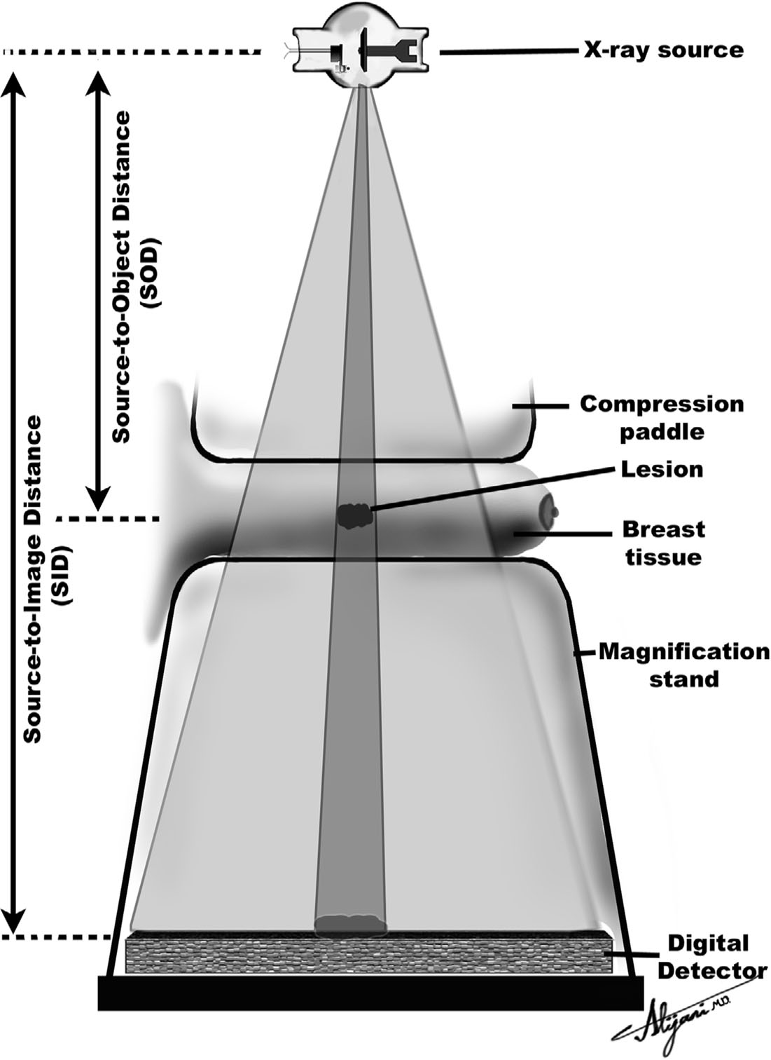 Figure 3-12. Anode heel effect. - Fundamentals of X-Ray Physics