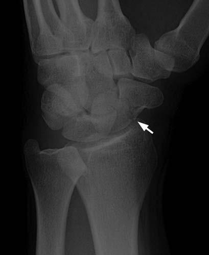 Radiologic Image