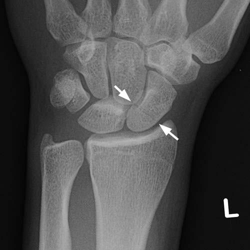 Radiologic Image