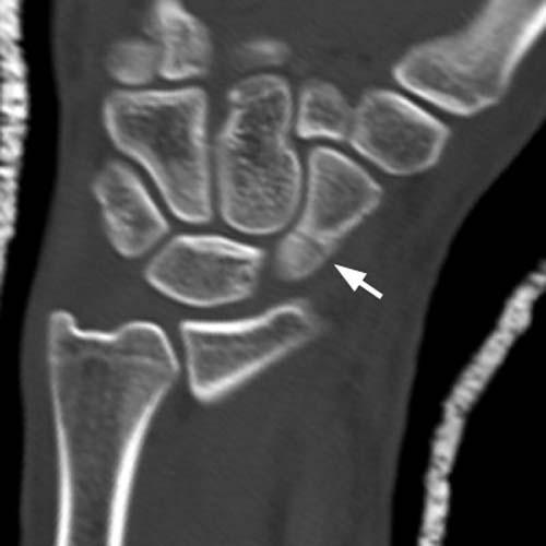 Radiologic Image