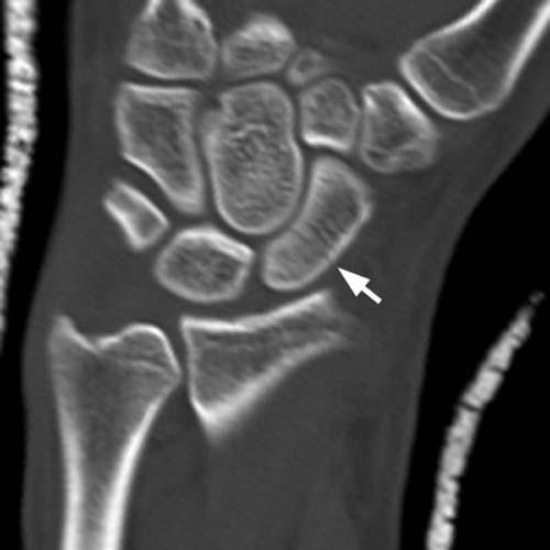 Radiologic Image