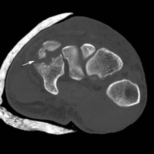 Radiologic Image