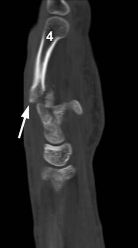 Radiologic Image