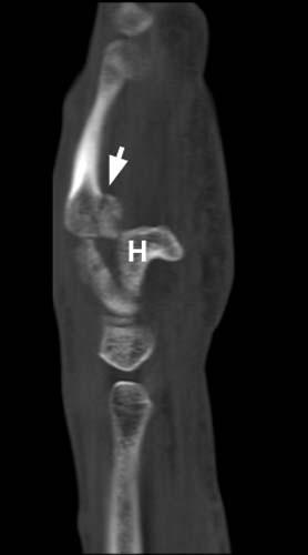 Radiologic Image