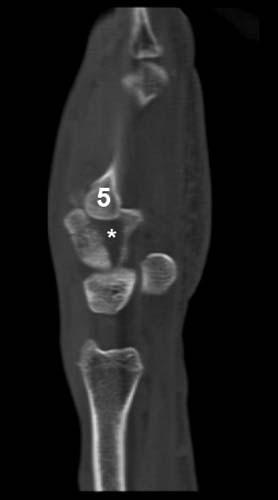 Radiologic Image