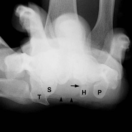 Radiologic Image