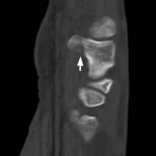 Radiologic Image