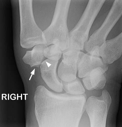 Radiologic Image