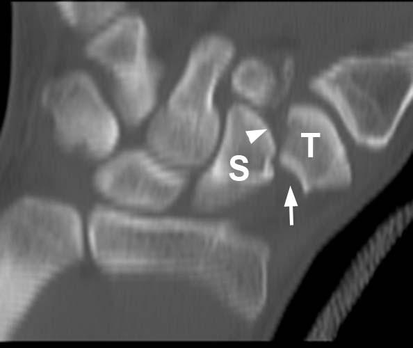 Radiologic Image