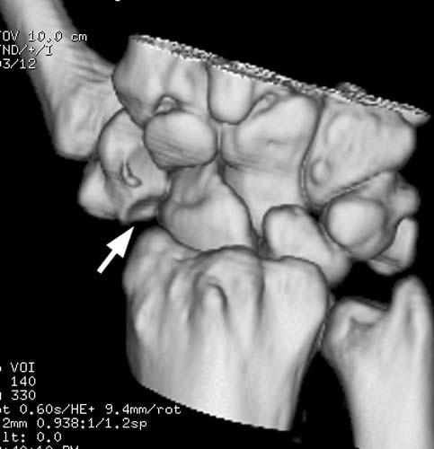 Radiologic Image