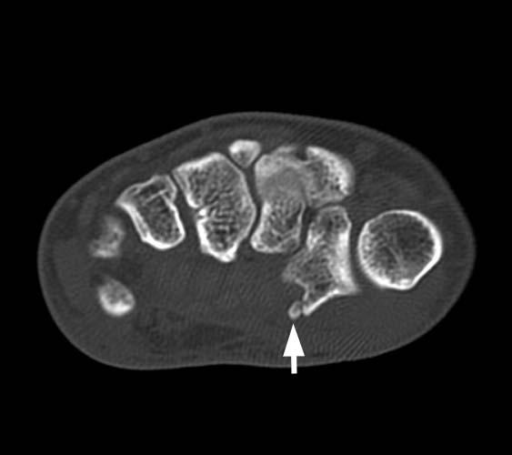 Radiologic Image