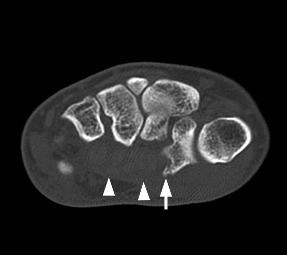 Radiologic Image