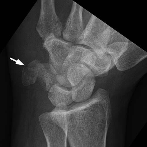 Radiologic Image