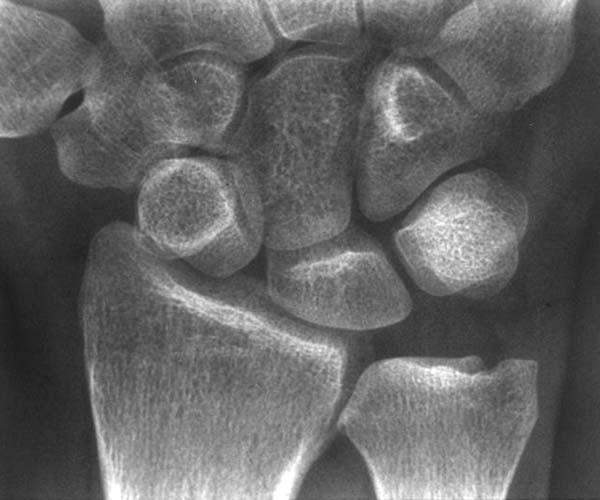 Radiologic Image