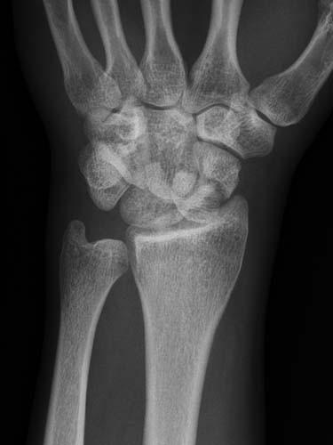 Radiologic Image