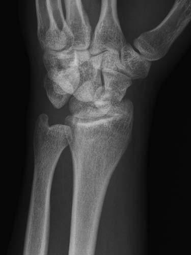 Radiologic Image