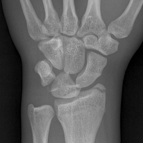 Forearm, Elbow, and Upper Arm | Radiology Key