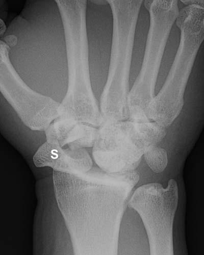 Radiologic Image