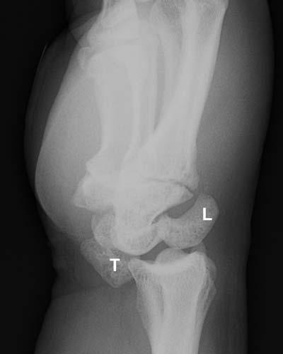 Radiologic Image