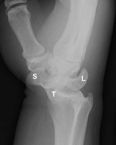 Radiologic Image